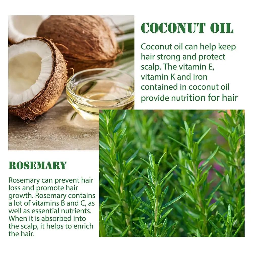 Huile essentielle de romarin pour la croissance des cheveux, AMP, améliore la perte de cheveux, nourrit, renforce les racines, traitement du cuir chevelu, soins capillaires