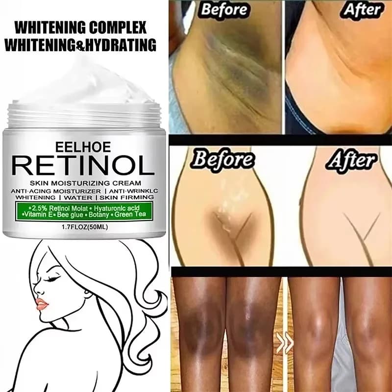 Crème Éclaircissante Corporelle pour Peaux Foncées, Aisselles et Zones Intimes, Lotion Corporelle Blanchissante pour Parties Privées, Beauté