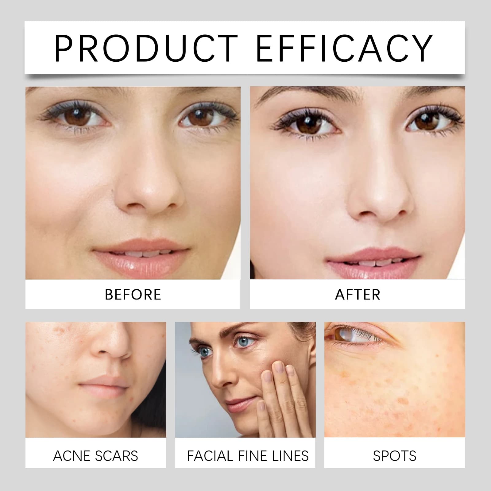 Hoygi crème antioxydante aux noix de vitamine C ton éclaircissant soirée correcteur de taches foncées hydratant léger absorption rapide de la peau