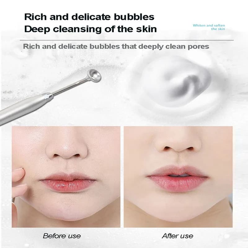Solution magique d'oxygène actif d'eau de bulle de nettoyage de Rose pour la Machine automatique Instrument de beauté soins de la peau du visage livraison directe