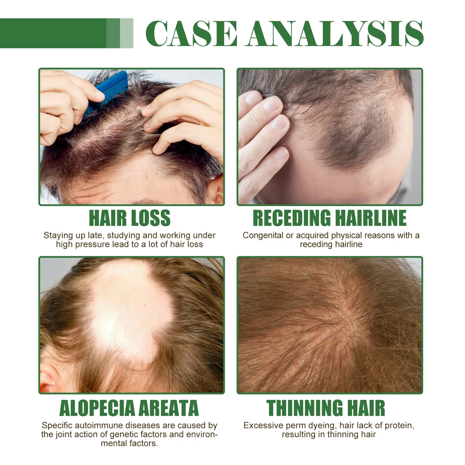 Huile pour la repousse des cheveux, prévient la casse des cheveux, améliore la santé du cuir chevelu, renforce les racines des cheveux, stimule l'activité des follicules, nourrit le cuir chevelu