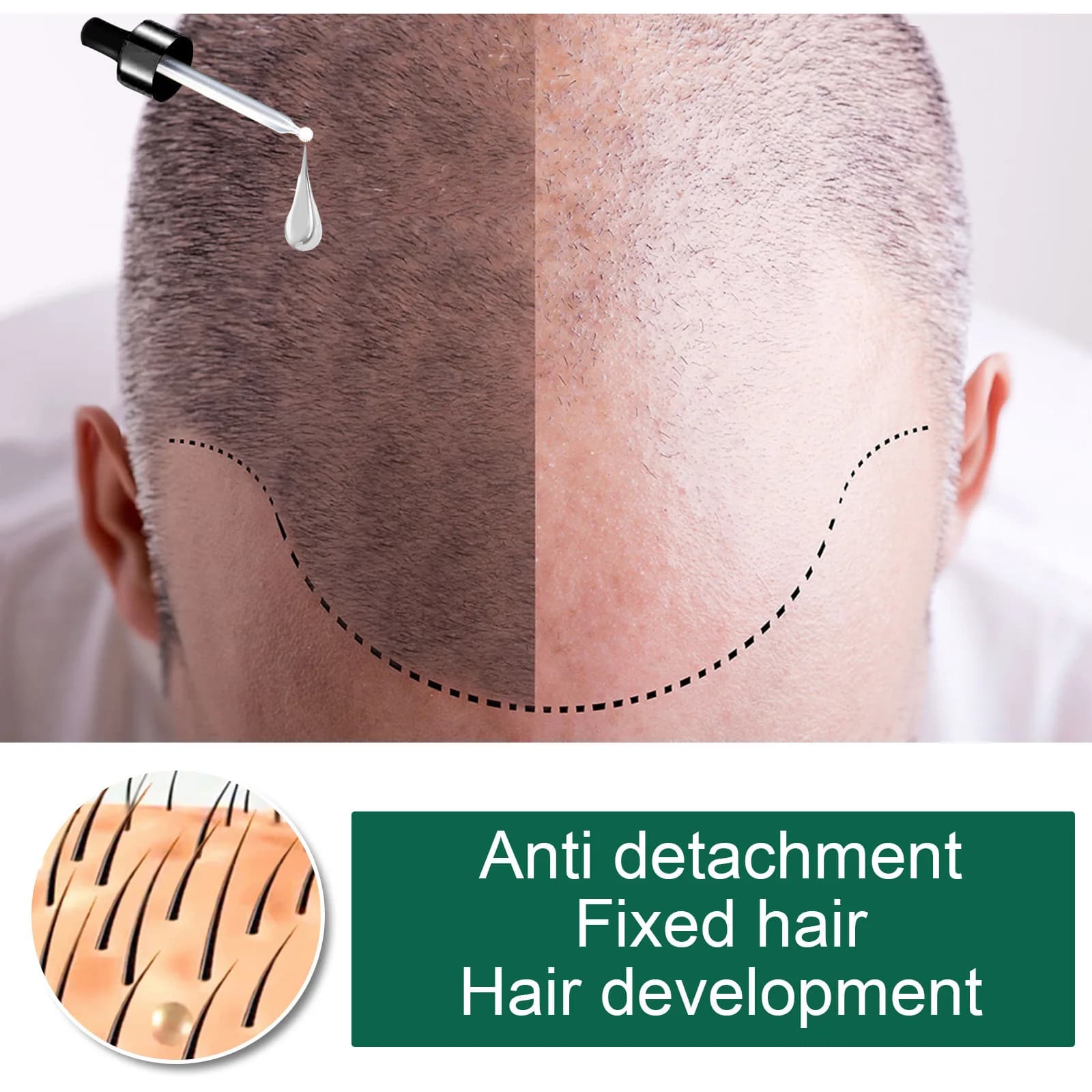Huile Essentielle Capillaire au Gingembre EELHOE : Hydrate et Adoucit les Cheveux, Répare les Cheveux Frisés et Abîmés, Huile Essentielle pour Soins Capillaires