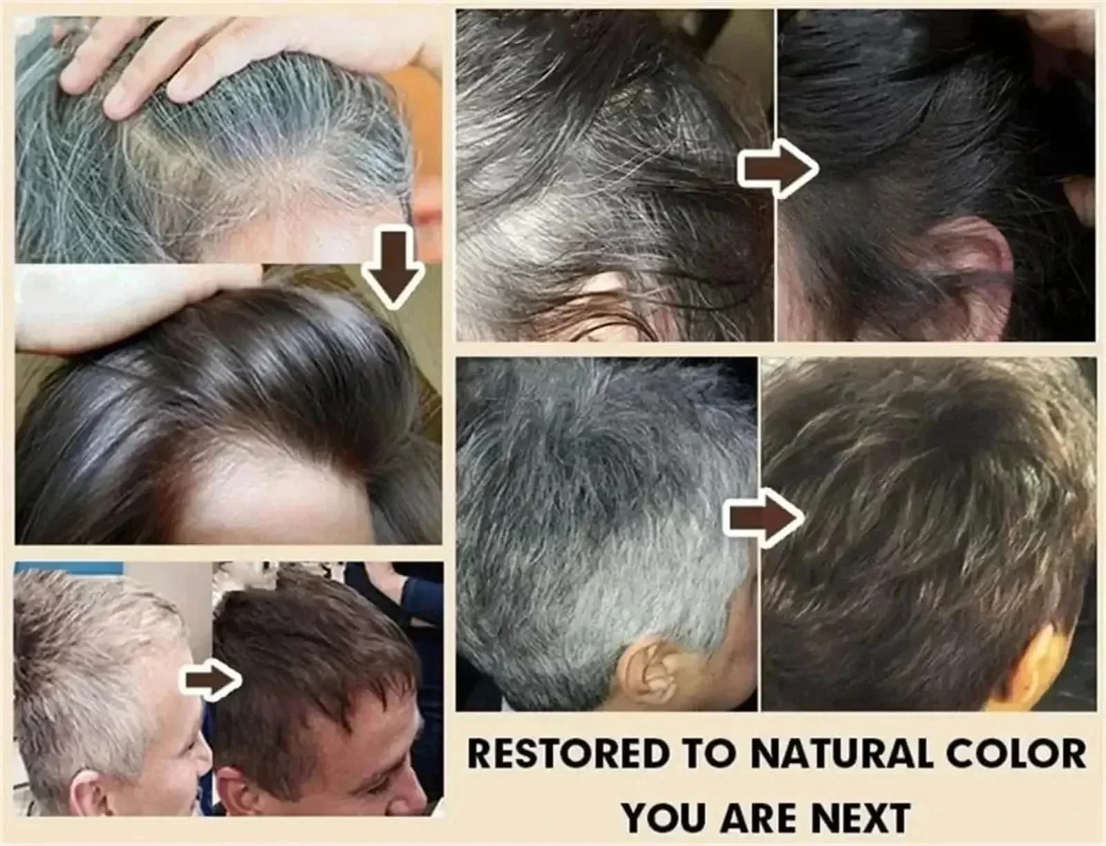 Sérum pour cheveux blancs à noirs, gris et blancs, réparation de couleur naturelle, nutrition, soin Anti-gris pour hommes et femmes * 5 & JI^
