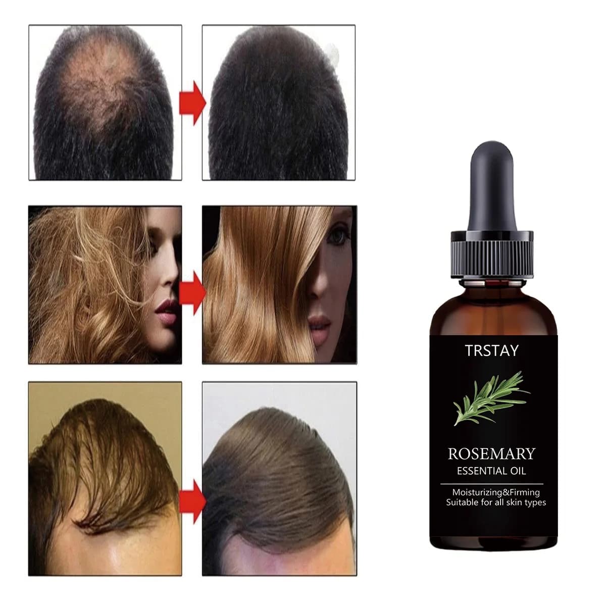 TRSTAY – huile essentielle de romarin pour le soin des cheveux, améliore les dragées des cheveux endommagés, les follicules bloquantes, active et la croissance, lubrifie les cheveux