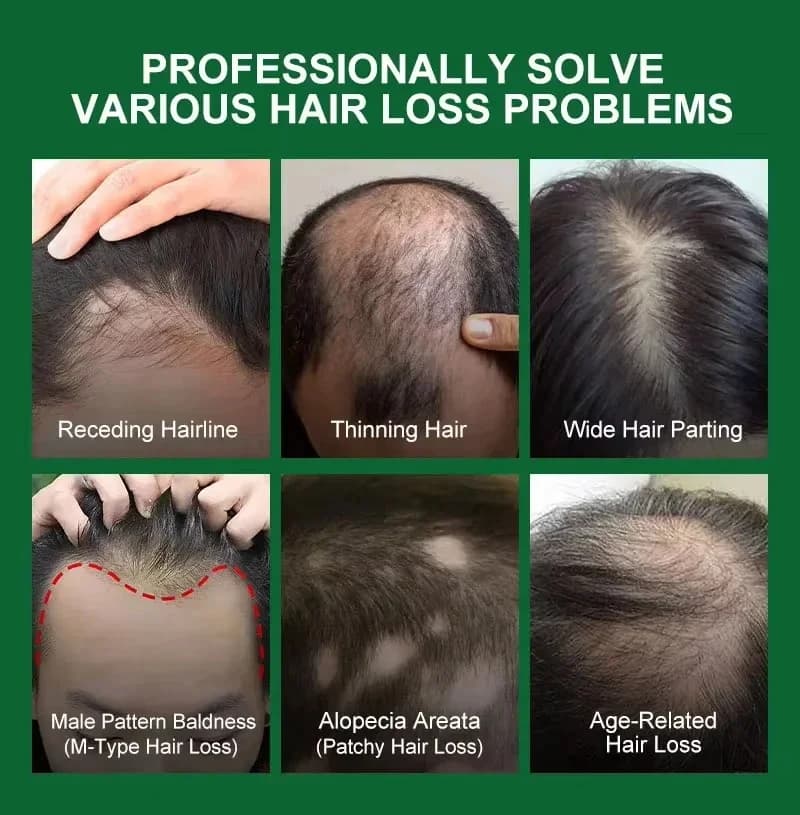 Sérum de croissance des cheveux