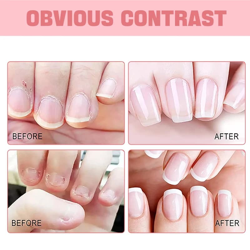 Huile pour ongles et cuticules, soin des ongles, hydratante, fortifiante, huile pour cuticules, hydratante - Pour des ongles plus forts et plus sains.