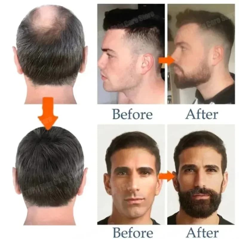 Dites au revoir à l'embarras de la barbe éclatée, cette huile essentielle de croissance vous aideront à cultiver une barbe satisfaisante