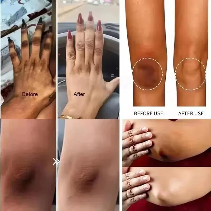 Crème blanchissante pour le corps peau foncée aisselles éclaircissante zones intimes aisselles blanchiment parties intimes crème blanchissante Lotion pour le corps beauté