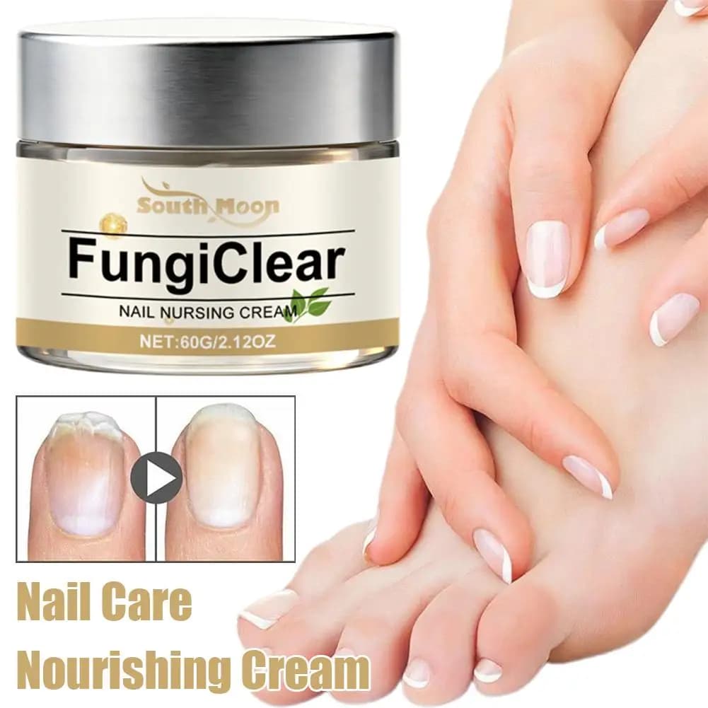 Crème de Soin des Ongles Anti-Fongique, Améliore l'Apparence des Ongles, Huile d'Origan, Huile d'Arbre à Thé, Vitamine E, Crème Quotidienne pour les Ongles