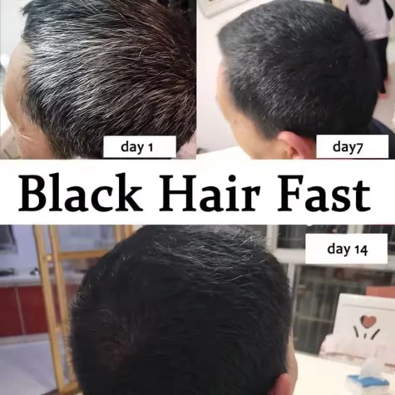 Shampooing Traitant Cheveux Gris Naturels et Blancs, Teinture Anti-Gris du Blanc au Noir, Anti-Chute, Nourrissant, Produits de Soin Capillaire pour Hommes et Femmes
