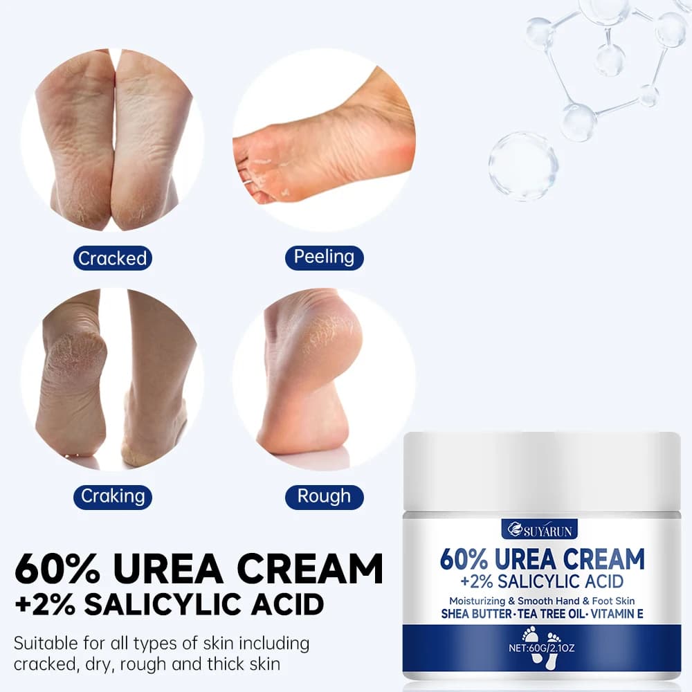 SUYARUN Crème pour les pieds à l'urée 60 % pour talons craquelés et peau sèche - Traitement hydratant intensif, dissolvant de callosités, soin des pieds diabétiques.