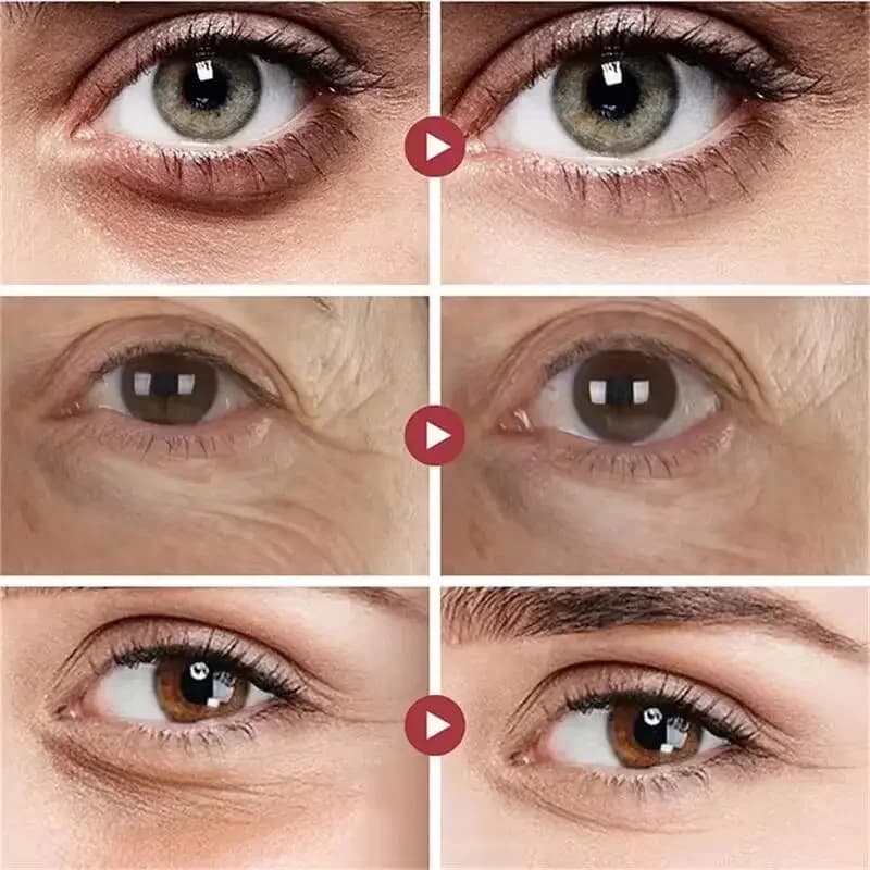 Les sacs pour les yeux crème élimine instantané les cernes resserre les yeux Lifting raffermissant et éliminant les poches pour les yeux créent vos yeux plus animés