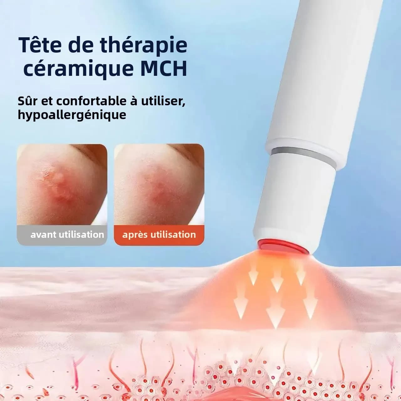 Appareil anti-démangeaisons pour piqûres de moustiques