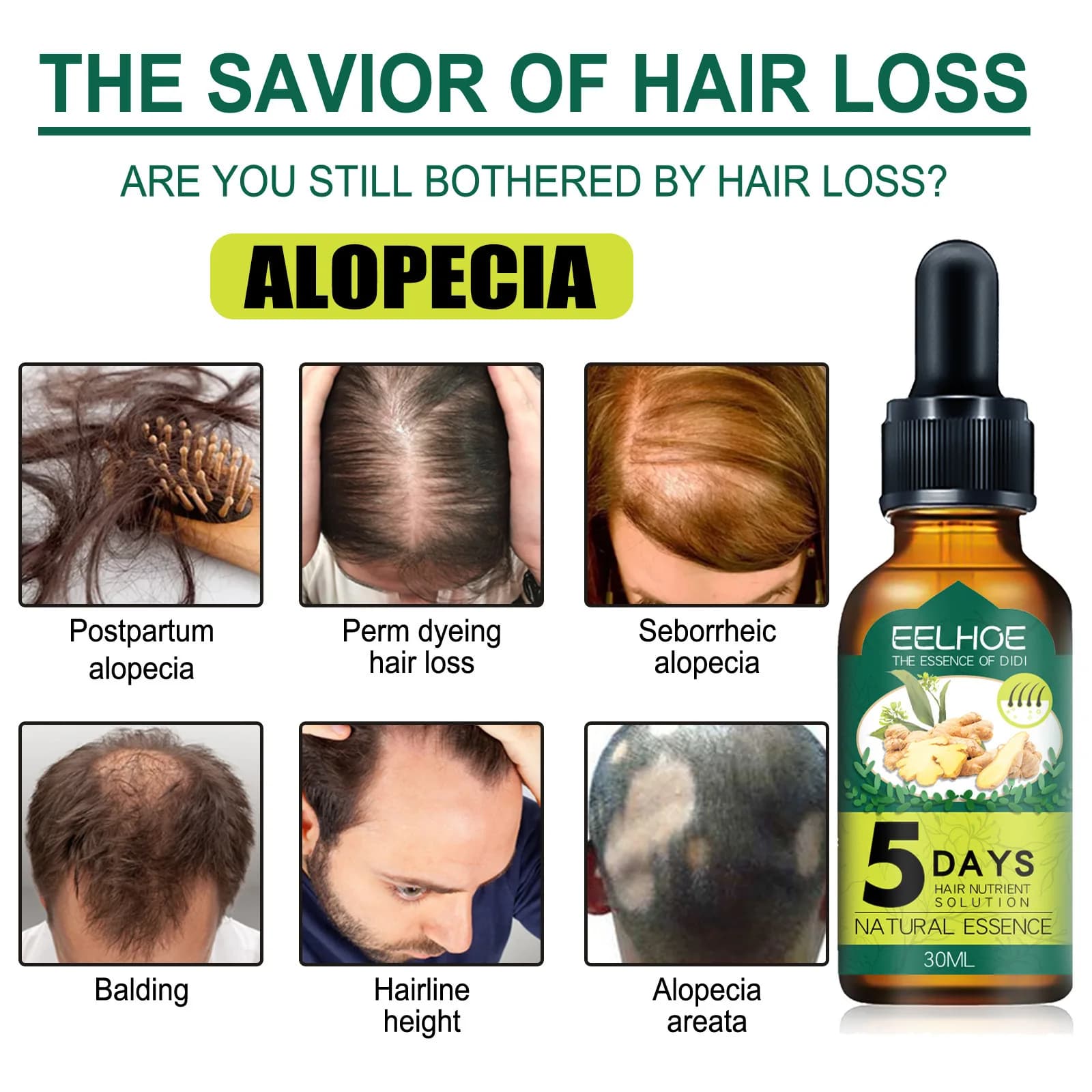 Huile Essentielle Capillaire au Gingembre EELHOE : Hydrate et Adoucit les Cheveux, Répare les Cheveux Frisés et Abîmés, Huile Essentielle pour Soins Capillaires