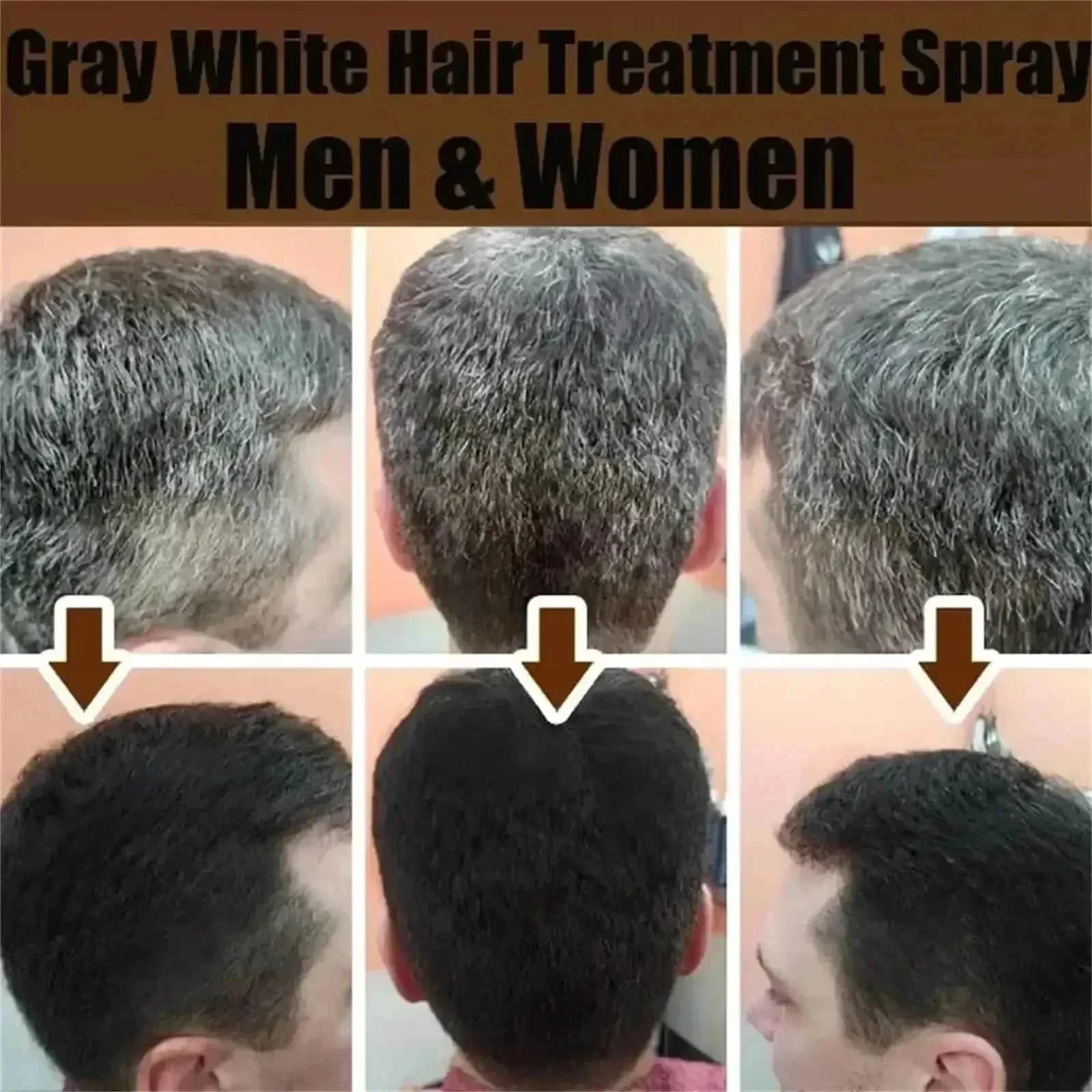 Sérum pour cheveux blancs à noirs, gris et blancs, réparation de couleur naturelle, nutrition, soin Anti-gris pour hommes et femmes * 5 & JI^