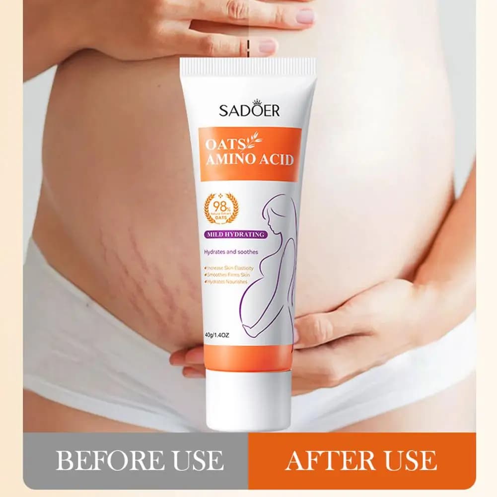 Crème anti-vergetures pour éliminer l'obésité post-partum, réparation des rides enceintes, Anti-âge, crème raffermissante pour le corps, soins pour la peau