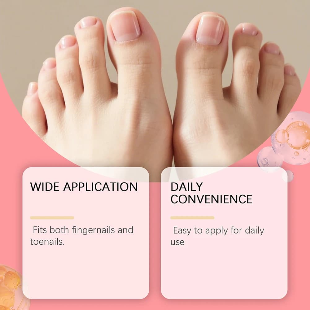 Solution de soin contre les champignons des ongles, Anti-Infection, réparation de l'onychomycose, ongles craquelés, main, pied, manucure, Essence de soins de santé, 15ml