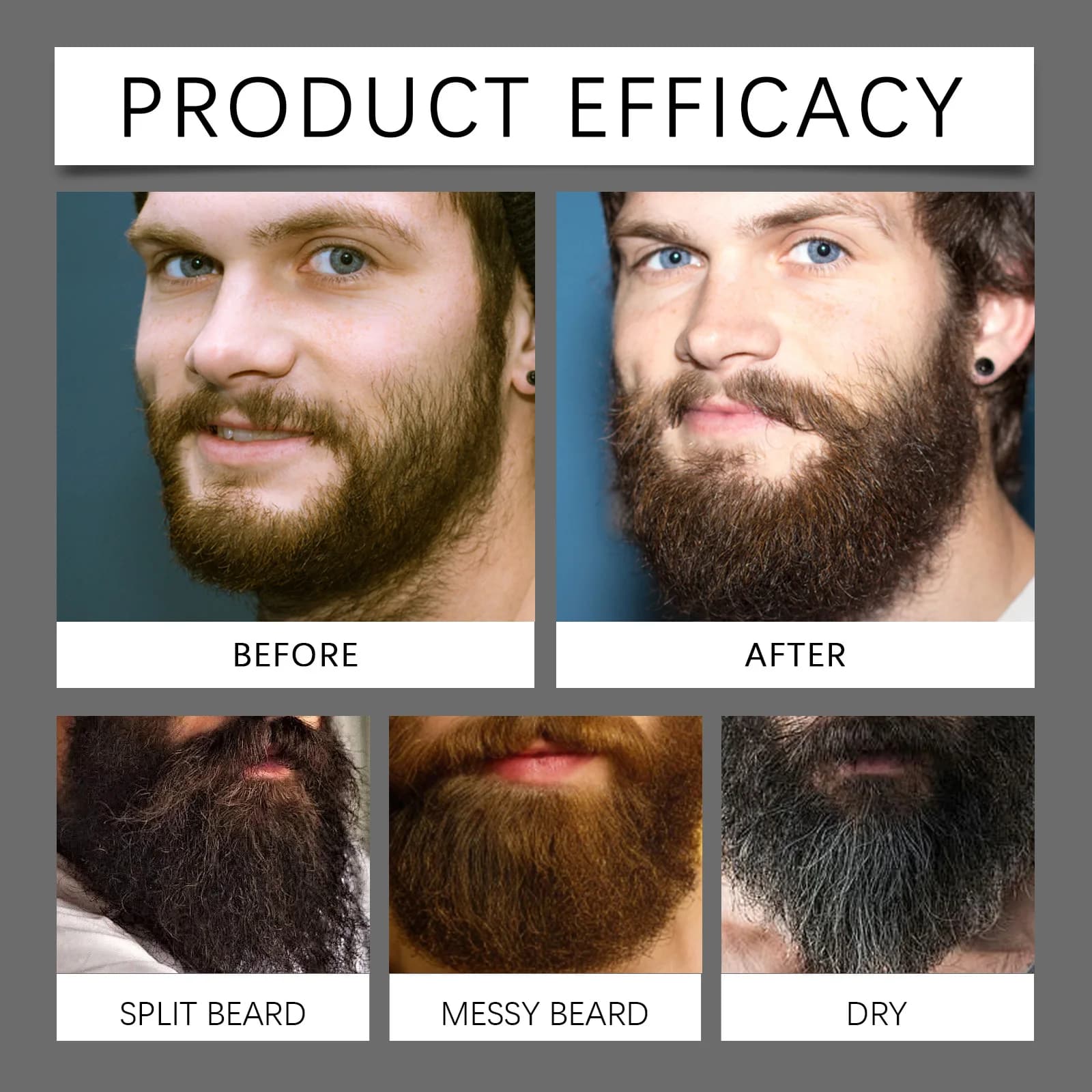 Huile de croissance de la barbe, sérum épaississant, favorise la croissance des poils, renforce les racines, adoucit la barbe, hydrate, soin masculin
