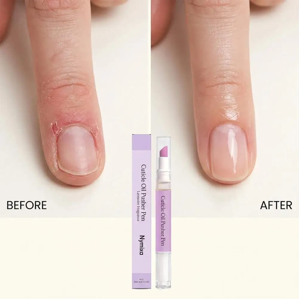 Stylo Huile pour Cuticules – Fortifiant et Nourrissant pour les Ongles – Élimine les Cuticules Abîmées et Faibles – Prévient les Ongles Abîmés – Huile Nourrissante pour Ongles
