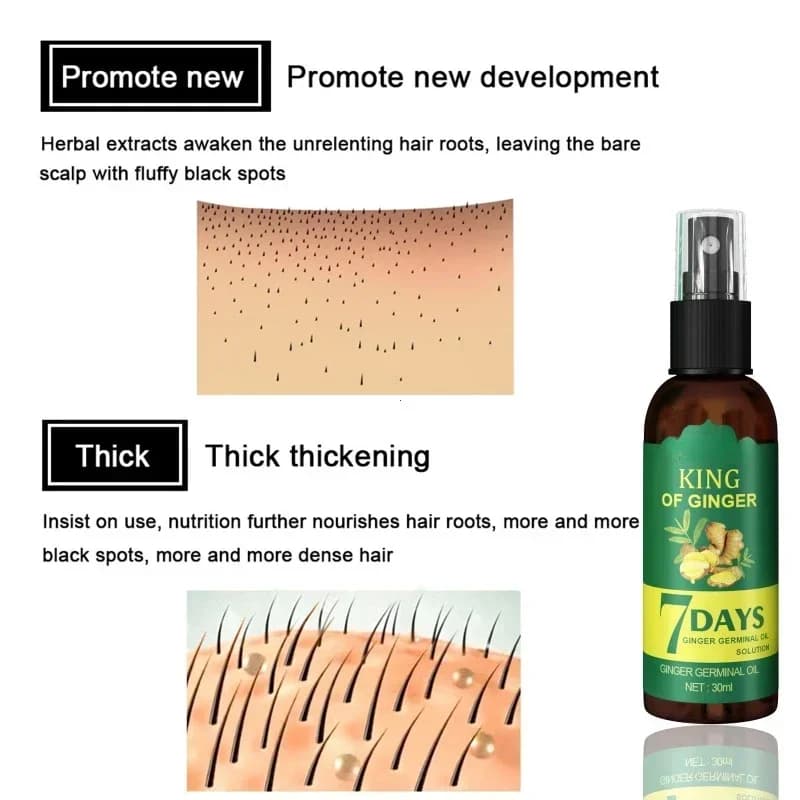 Spray de croissance des cheveux au gingembre, Massage renforcé du cuir chevelu, renforcement des cheveux denses, prévention de la perte de cheveux, liquide nourrissant réparateur