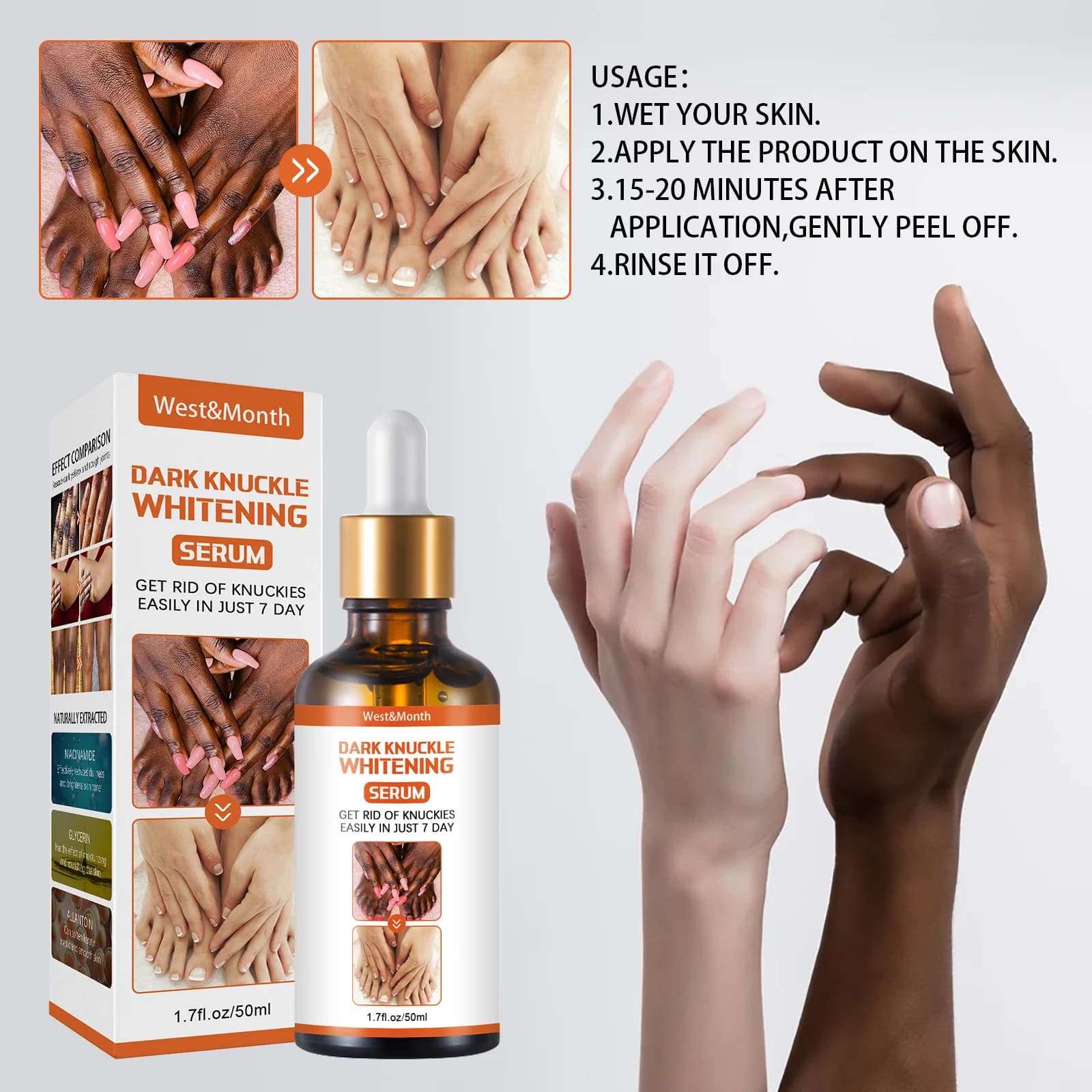 Sérum éclaircissant pour les articulations foncées, 50ml, pour les mains, les coudes, les genoux, huile éclaircissante, dissolvant de taches intenses, produits de soins de beauté