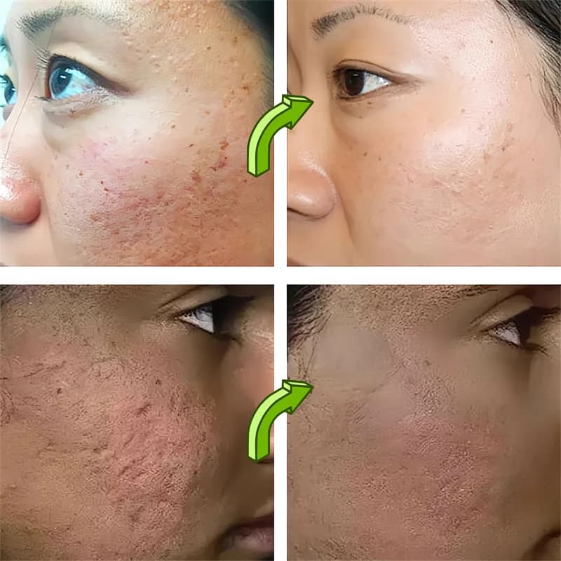 Sérum pour nettoyer les Pores du visage, délicat, tendre, hydratant, contrôle de l'huile, rétrécit les Pores, peau rugueuse, soins lisses, éclaircissant, cosmétiques coréens