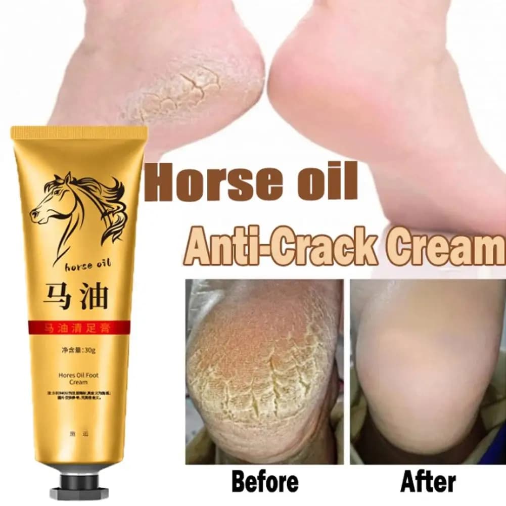 Crème Premium Hydratante à l'Huile de Cheval pour Mains et Pieds – Soin Réparateur pour Peaux Sèches et Gercées – Adoucit la Peau