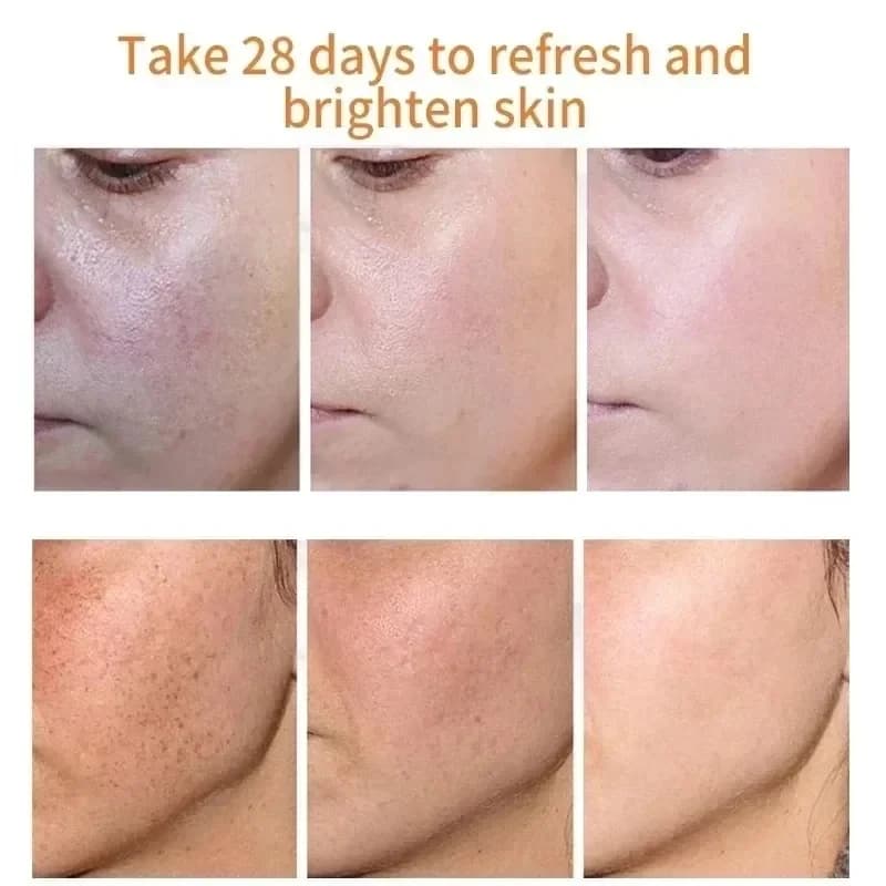 Crème blanchissante à la niacinamide pour le visage, estompe les taches de rousseur et les taches foncées, améliore la vitalité tactique, nourrit rapidement les soins de la peau