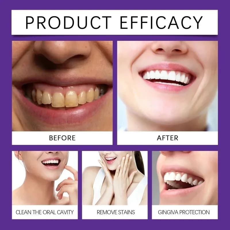 Poudre Minérale Violette pour la Restauration Dentaire – Éclaircissante, Blanchissante, Sûre pour l'Émail – Poudre Dentifrice Renforçante pour les Dents, Répare le Tartre et les Gencives