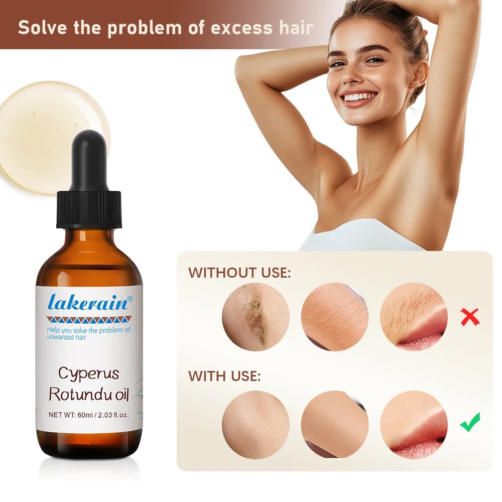 Inhibe la croissance des cheveux 60 ml d'huile de Cyperus Rotundus nourrit les ingrédients de la peau sont en toute