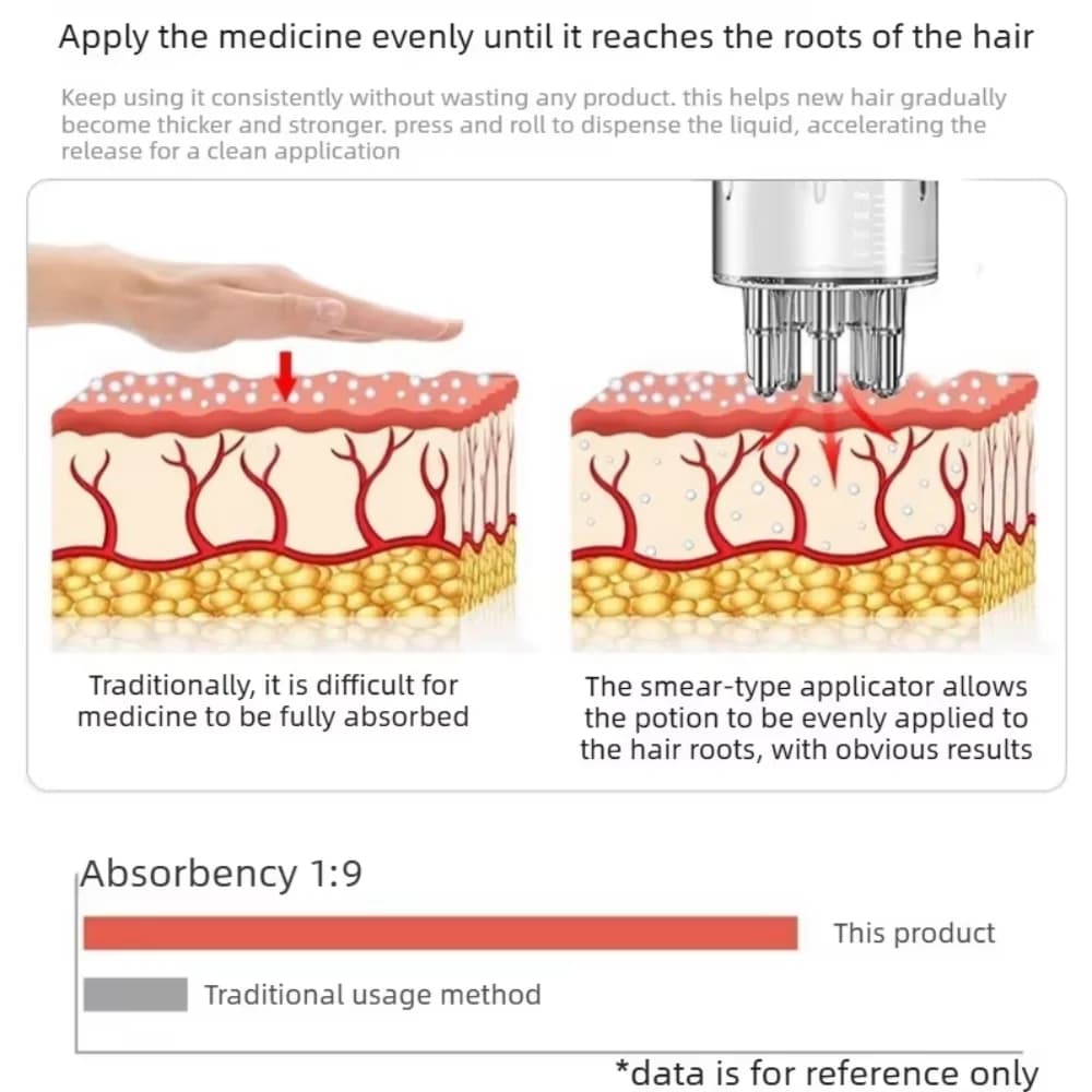 Applicateur Portable pour Cuir Chevelu, Rouleau Applicateur d'Huile Essentielle Liquide, Peigne de Massage Liquide, Peigne à Cheveux, Outils de Soin du Cuir Chevelu Anti-Chute de Cheveux