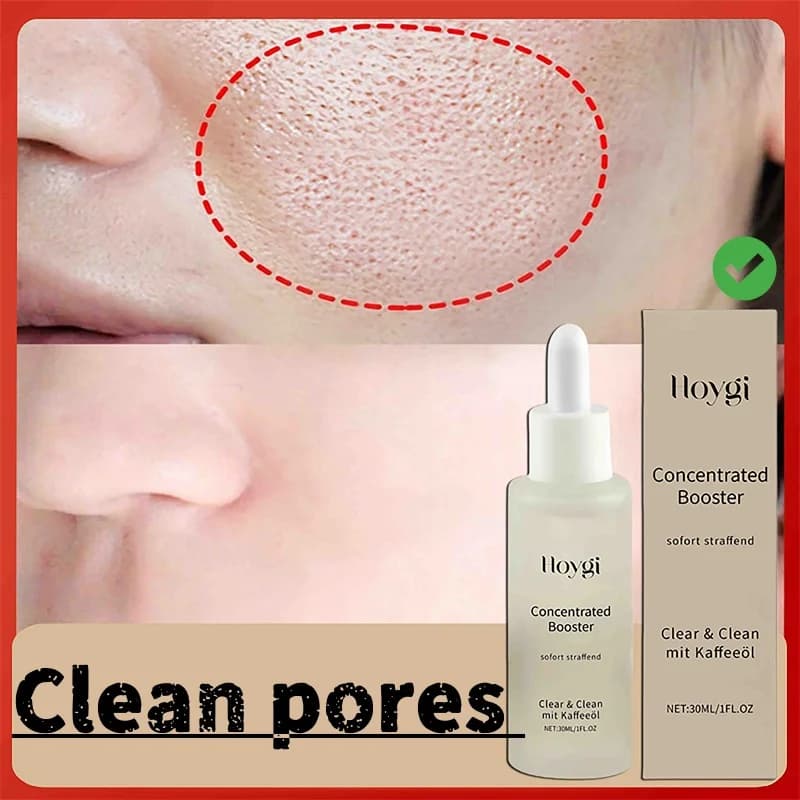Sérum pour nettoyer les Pores du visage, délicat, tendre, hydratant, contrôle de l'huile, rétrécit les Pores, peau rugueuse, soins lisses, éclaircissant, cosmétiques coréens