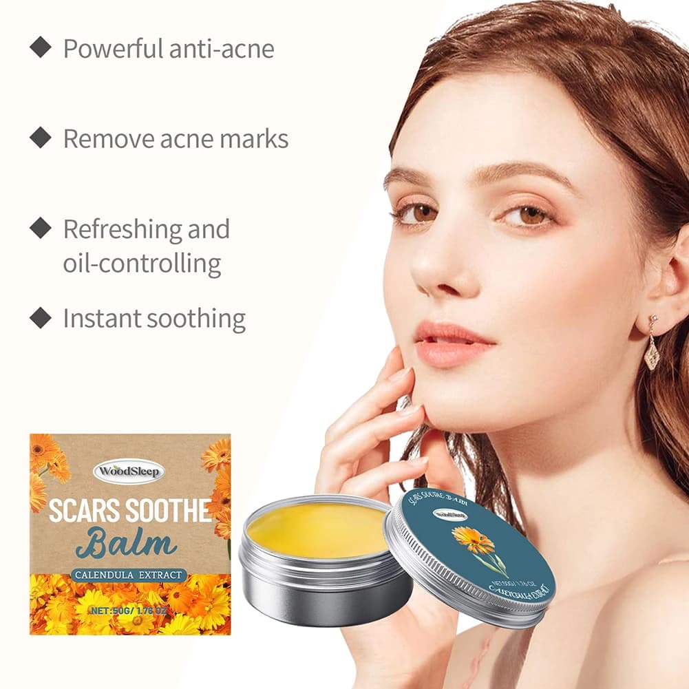 Crème pour le visage à l'extrait naturel de Calendula, 50g, pour l'acné hormonale, apaise les rougeurs, calme l'acné, crème à base de plantes pour peau grasse