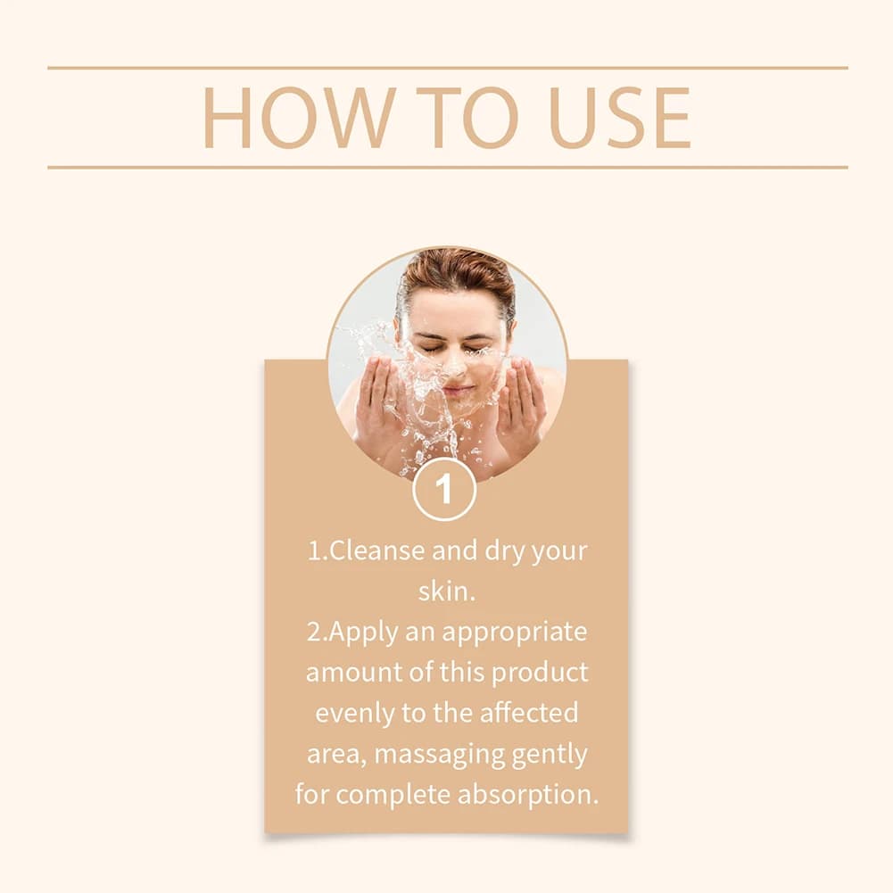 Crème pour le visage à l'extrait naturel de Calendula, 50g, pour l'acné hormonale, apaise les rougeurs, calme l'acné, crème à base de plantes pour peau grasse