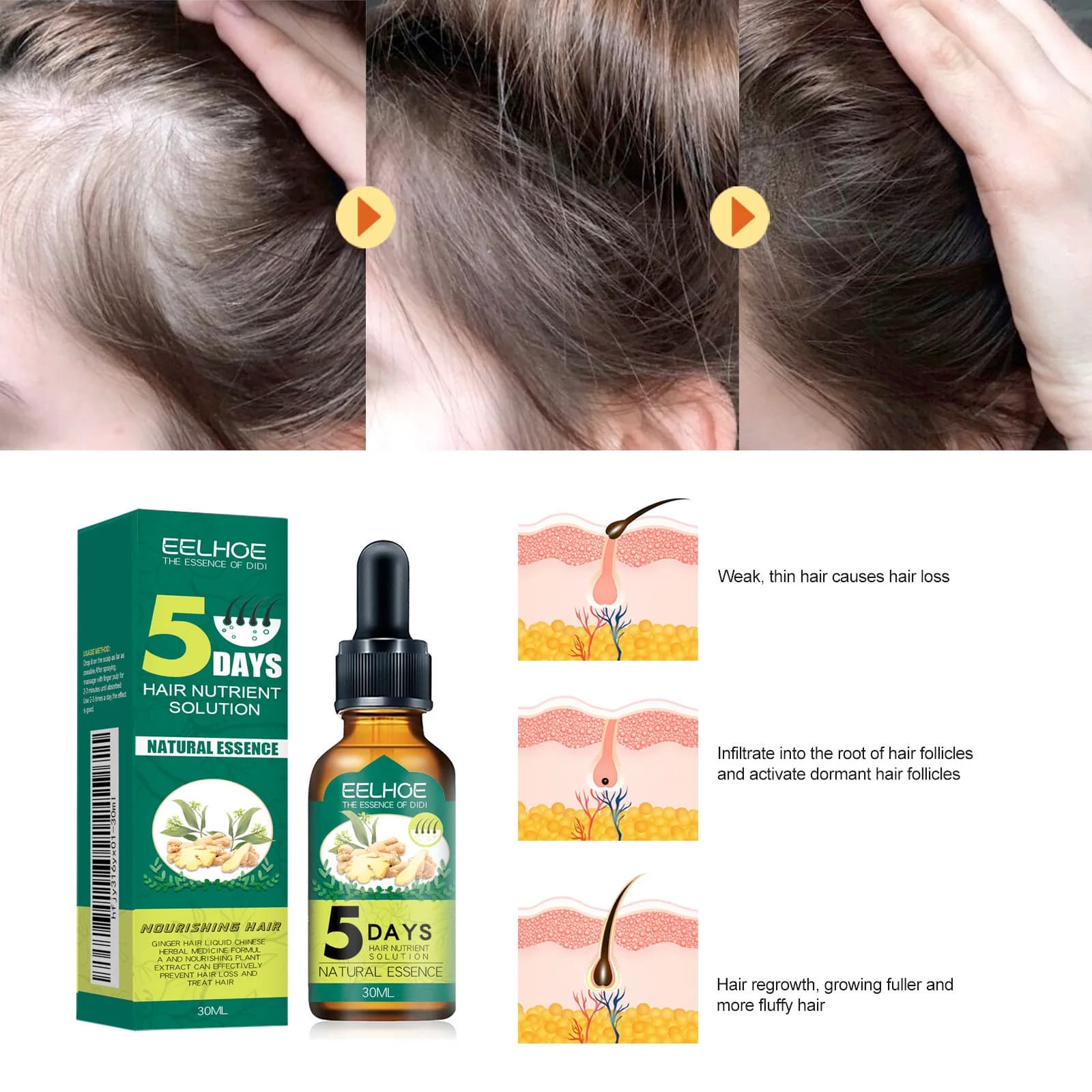 Huile Essentielle Capillaire au Gingembre EELHOE : Hydrate et Adoucit les Cheveux, Répare les Cheveux Frisés et Abîmés, Huile Essentielle pour Soins Capillaires