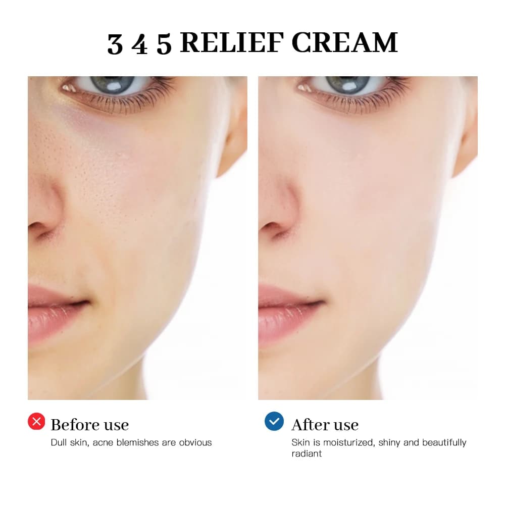345 crème de soulagement solution complète pour les problèmes de peau Anti-ouille et antioxydant éclaircissant la peau améliorant les marques d'acné Moistu