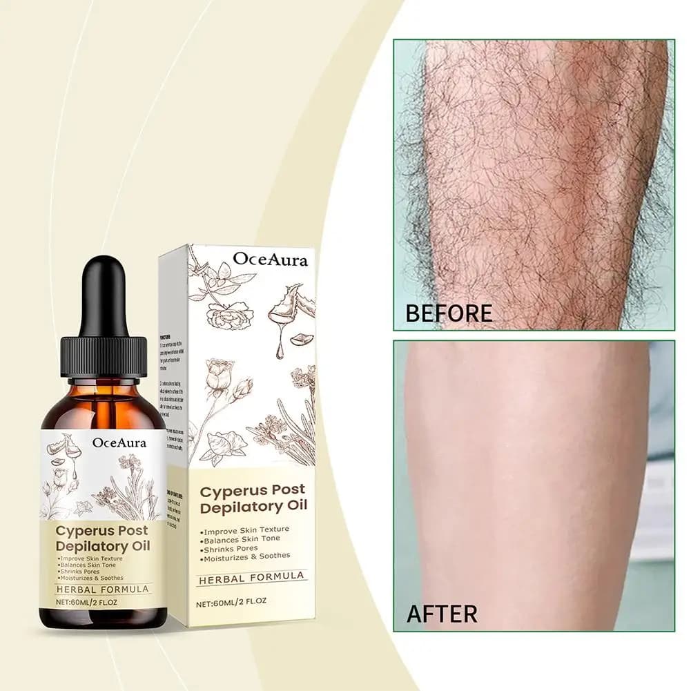 Huile Essentielle Naturelle de Cyperus Rotundus 60ml pour l'Épilation, Hydratante, Apaisante, Réductrice de Poils Corporels, Indolore Après l'Épilation