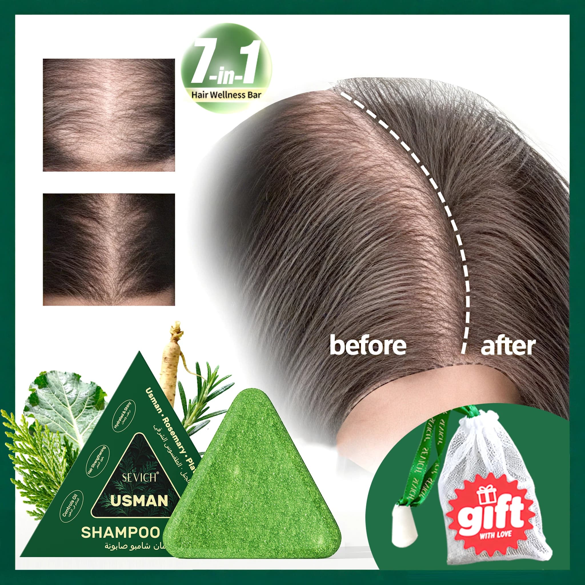 120g Usman herbe & Platycladus shampooing savon renforcer la croissance des racines des cheveux shampooing barre naturel à base de plantes traitement de perte de cheveux soins capillaires