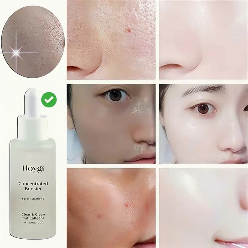 Sérum pour nettoyer les Pores du visage, délicat, tendre, hydratant, contrôle de l'huile, rétrécit les Pores, peau rugueuse, soins lisses, éclaircissant, cosmétiques coréens