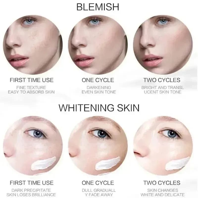 1/3/5 pièces crème blanchissante pour les taches de rousseur Niacinamide élimine les taches foncées crème Anti-taches de rousseur et vieillissement estompe Pigmentation Melasma peau
