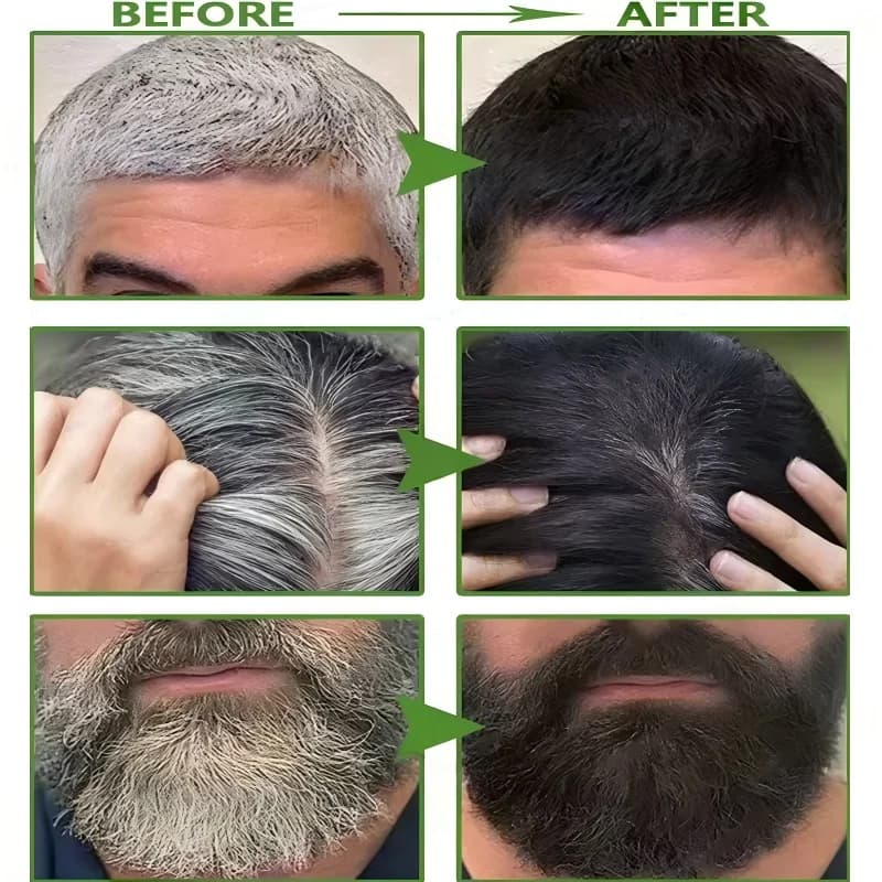 Shampooing Traitant Cheveux Gris Naturels et Blancs, Teinture Anti-Gris du Blanc au Noir, Anti-Chute, Nourrissant, Produits de Soin Capillaire pour Hommes et Femmes